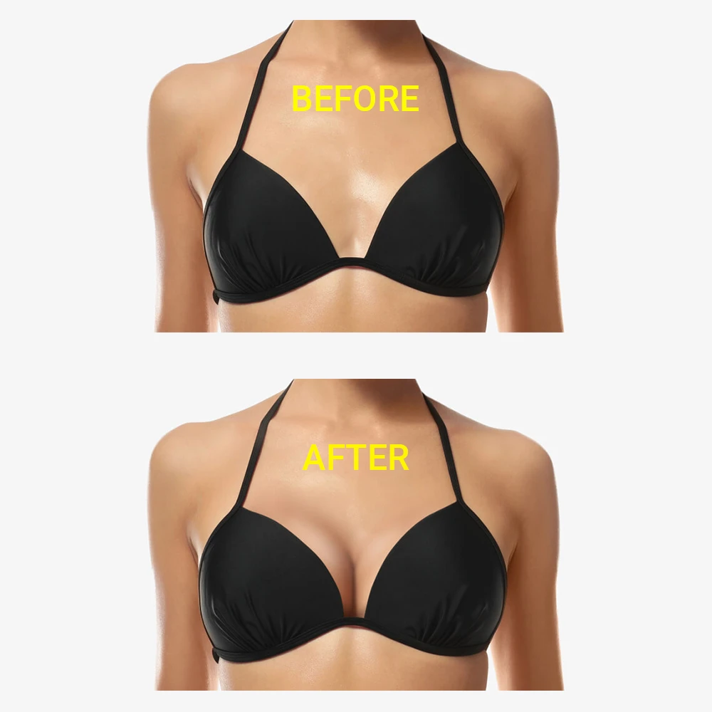 before-after-korio-bra-pad-ultra-lift Magic Sticky Bra Pad Insert Ultra Lift