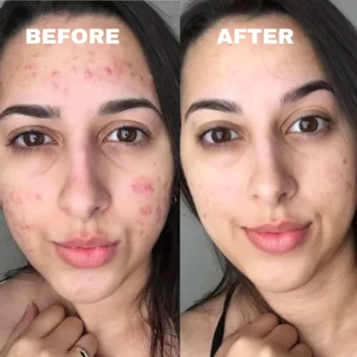 Cleansing Rejuvenation Device 2 in 1