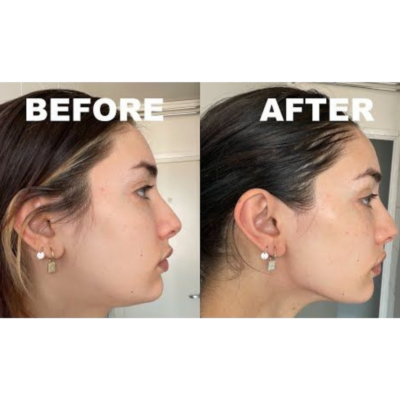 guasha stone original